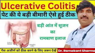 Ulcerative Colitis Treatment: प्राकृतिक इलाज से पाएं आराम | Symptoms & Diet Plan | Dr. Ramakant