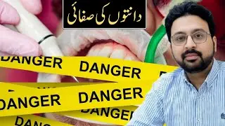How Repeated Teeth Scaling Can DAMAGE Your Teeth & Gums | Dentist Explains the Truth!