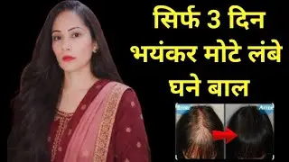 Extreme Hair Growth Challenge (2026) To Grow Long Thik Hair 