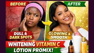 Whitening Vitamin C Lotion Promix | Brighter Skin, Smooth Texture & Healthy Glow