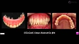 Clinical Case by Prof. Peter Moy - What would you do?