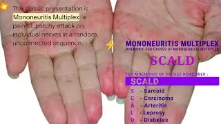 🩹 Mononeuritis Multiplex  🩹