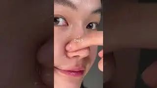 pore mizing serum