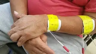Neuro Reeducation in a patient with Stroke