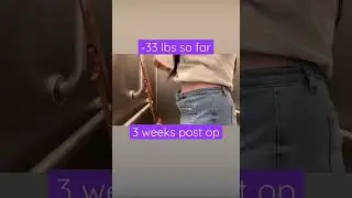 This is including the -17 lbs from preop month diet. #siiriparkss #gastricsleeve #weightlossjourney