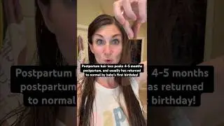 Postpartum hair loss is wild #shorts #pregnancy #postpartum