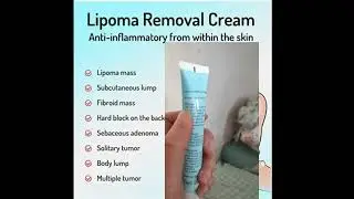 3PCS Effectively Removal Lipoma Fibroids Cream Lipolysis Fat Body Cream Dissolving