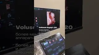 Первый в России 🇷🇺 Voluson Expert 20