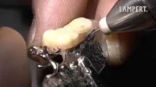 PUK dental welding - very low heat development