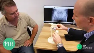 Do I need a hip replacement?