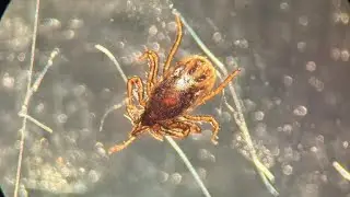 &lsquo;They&rsquo;re all over&rsquo;: UD professor says Dubuque&rsquo;s tick population is growing