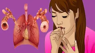 Dry Cough With Chest Pain: Main Causes