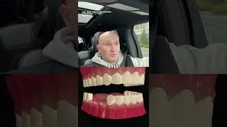 Czym Są Mosty Dentystyczne? 🌉🦷