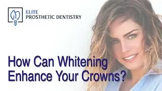 How Professional Dental Whitening Enhances Our Dental Crowns to Ensure they Match Your Natural Color