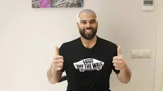 Greffe de cheveux de Nore Abdelali. byhairclinic hair transplant center istanbul turkey