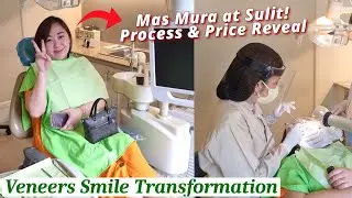 PRICE REVEAL! Mas Mura at Sulit | Veneers Smile Transformation - Process & Costing (Mommy O)