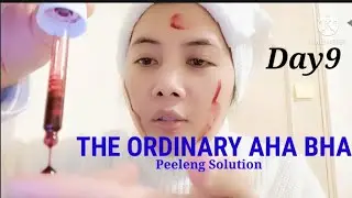 CARA MENGHILANGKAN FLEK HITAM DI WAJAH DENGAN THE ORDINARY AHA 30%+BHA2% PEELING SOLUTION