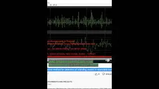 Multivariable passive method for detection of islanding events in renewable energy based power grids