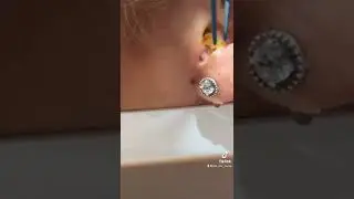 It just didn&rsquo;t want to see the light -  #earwax #earwaxremoval #theearnurse #earskin