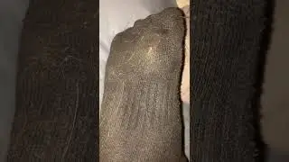 Sweaty sock removal #feet