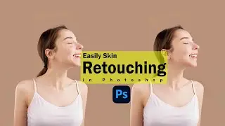 How to easily remove Acne or  Pimples in photoshop