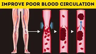 10 Healthy Habits That Increase Your Poor Blood Circulation!