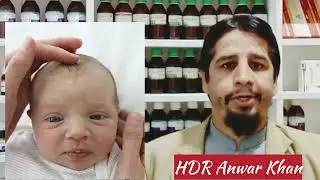 baby soft spot on head, newbornbaby front and Back Fontanelles.Homoeo treatment.