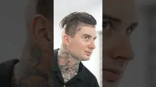 Unshaved Hair Transplant ~Long Hair Center