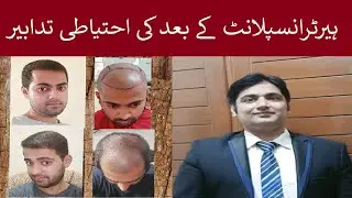 Hair transplant in faisalabad | Best hair transplant surgeon in pakistan | best hair transplant |