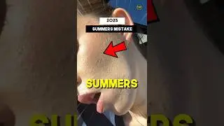 😱3 Summer Skin Mistakes | Day-07/60 | #shorts #skincare #factsmensfashion