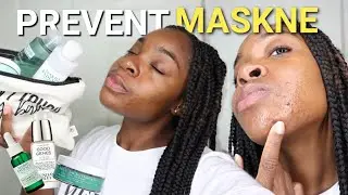 BEST Products for Face Mask Acne | PREVENT & TREAT #MASKNE BREAKOUTS | Tam Kam