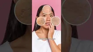 How to Treat Acne Scars & Open Pores #skincare #pores #scars