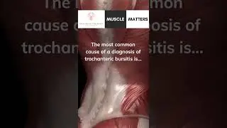 Hip Bursitis Explained: True Hip Pain Cause and Treatment