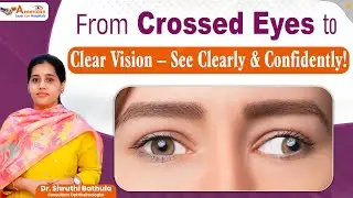 What Causes Squint Eyes? | Squint Eye Correction | Genetic Eye Problems | Dr Shruthi Bathula