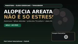 Alopecia Areata Com Óleos Essesnciais!