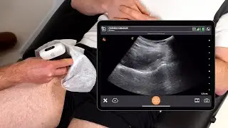 Сканирование бедра