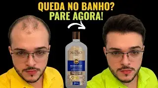 Shampoo Tio Nacho: Funciona? Queda de Cabelo e Calv&iacute;cie: Vale a Pena?