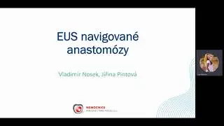 EUS navigované anastomózy