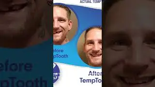 Temptooth: The #1 Temporary Tooth Replacement&rdquo;    #Temptooth#fixteeth#quicktoothpix#viral#trending
