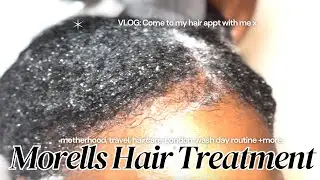 Vlog: Getting My Hair Treatment &Trim Done at Morells | Hair Day | 4a/4b Hair | Review