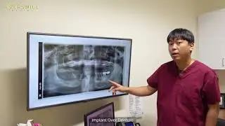 [Eversmile Dental] Dr.Jung Implant Over Denture