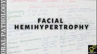 Facial Hemihypertrophy | Developmental Disturbances Of Jaws Part -4