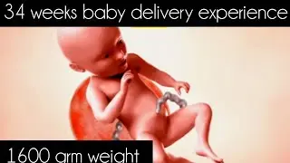 34 weeks baby delivery experience Keerthi&yoga vlogs 