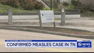 Knox County Health Department: What to know after measles confirmed in TN