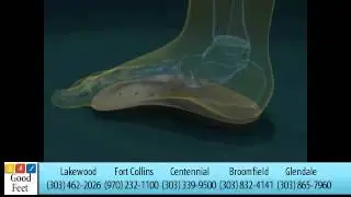 Good Feet Denver Repetitive Movement Foot Pain Relief with Good Feet Arch Supports #8