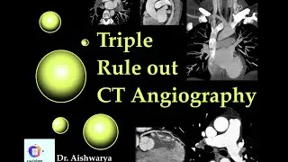 TRIPLE RULE OUT CT ANGIOGRAPHY l Radiology explained. Radiology defined.