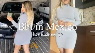 I got a bbl + Lipo360, bichectomy, chin lipo, arm lipo in Mexico at 20 years old| part 3| Chanel Liz