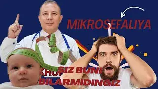 MIKROSEFALIYA HAQIDA Dr.JALILOV DAN TO'LIQ MALUMOT