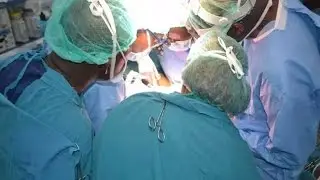 Separated conjoined twins recovering at Kenyatta&rsquo;s ICU ward