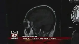 Study: Sleep patterns, brain recovery related